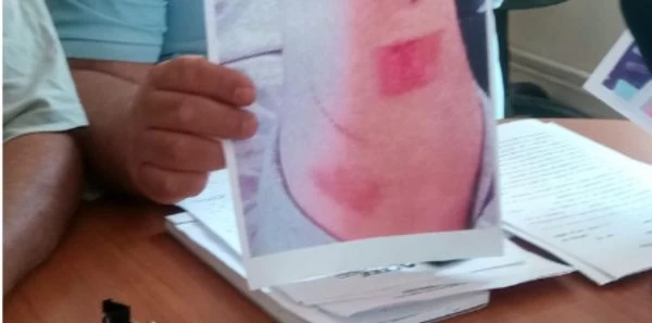 Κέρκυρα: «Μεσαιωνικά» βασανιστήρια σε γνωστό εστιατόριο έζησε σπουδαστής μαγειρικής (εικόνες)